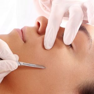 dermaplaning